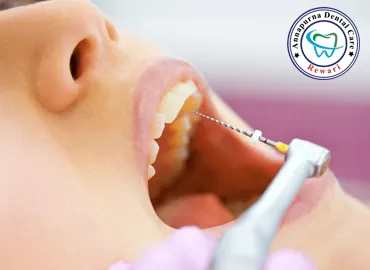 Root Canals